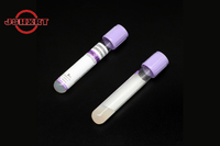 Glue EDTAK2 + separation